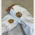 Gold Flower 5 Pink Button Cover